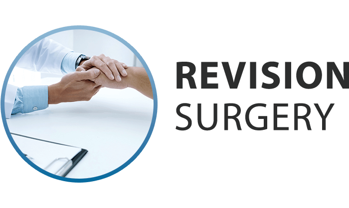 ib-serv-revision_surgery